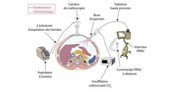 https://gamida.fr/wp-content/uploads/2024/05/illustration_pipac_3_578x300.jpg